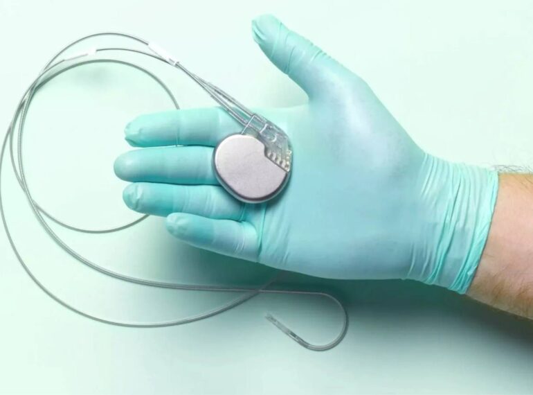 Pacemaker & Defibrillator Implantation